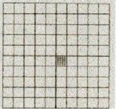 RETÍCULO DE WHIPPLE